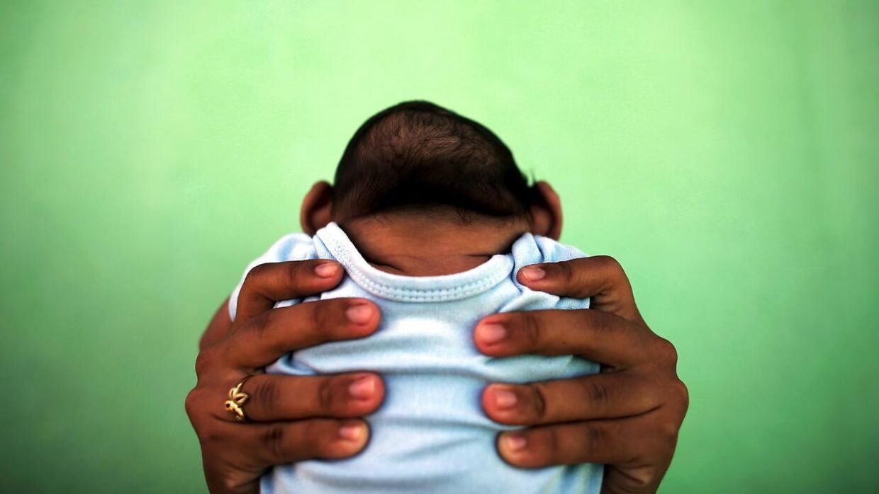  Jackeline på 26 fødte en lille dreng i Brasilien, hvis kraniet er meget anderledes end andre nyfødtes. Han har fået misdannelser efter Zika virus.