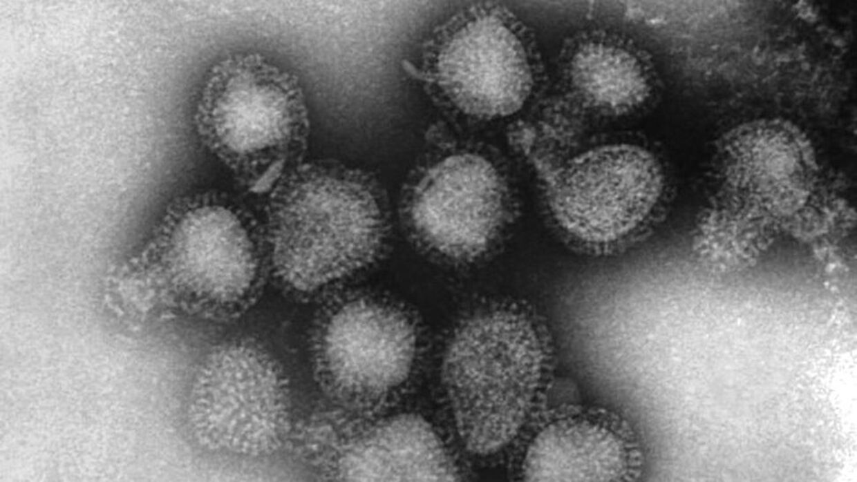 Influenza-virussen