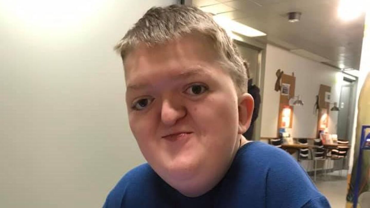 12-årige Silas er født med Crouzons Syndrom, der bevirker, at hans kranieplader vokser sammen. Han blev desværre udsat for mobning fra andre børn, da han tirsdag besøgte Københavns Zoo.