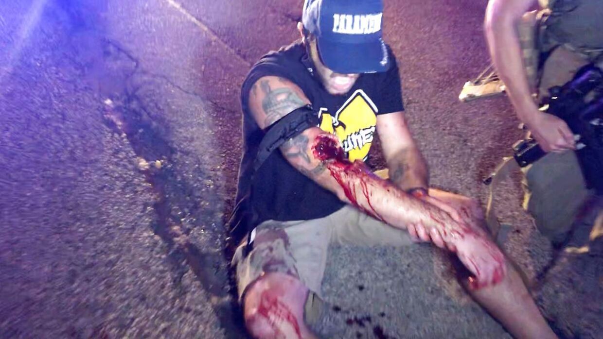En mand er blevet såret under demonstrationerne.