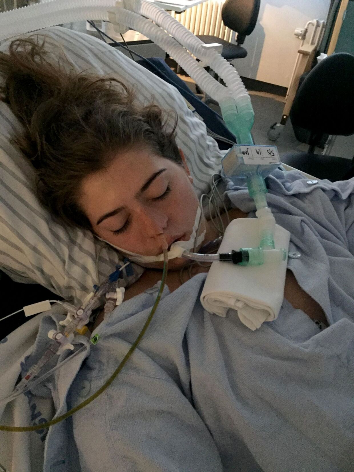 17-årige Mathilde i sygesengen, mens hun er ramt af kødædende bakterier.