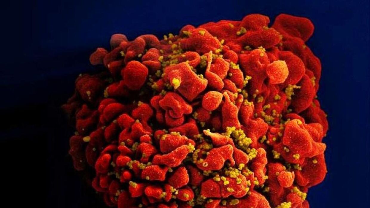 En kvindes immunforsvar har med stor sandsynlighed kureret sig selv for hiv 