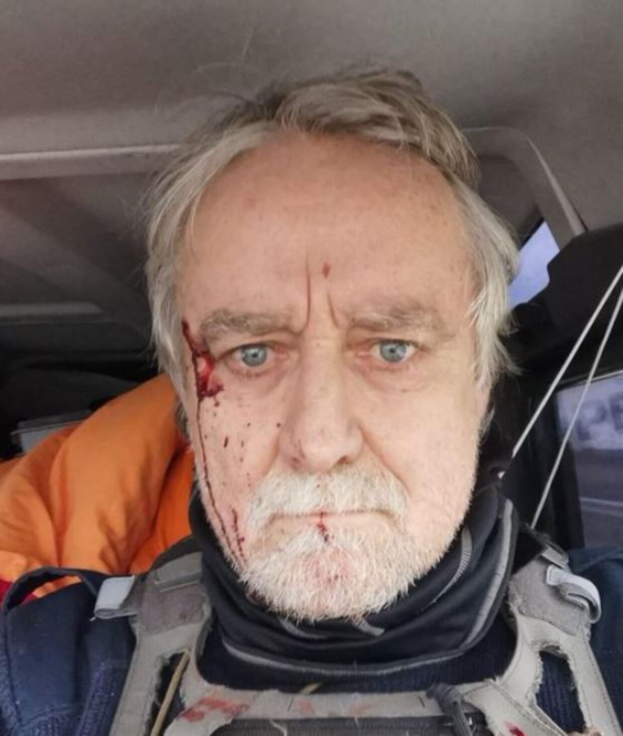 Den schweiziske fotojournalist Guillaume Briquet blev ifølge Journalister uden grænser beskudt af russiske kommandosoldater, mens han udførte sit arbejde i Ukraine.