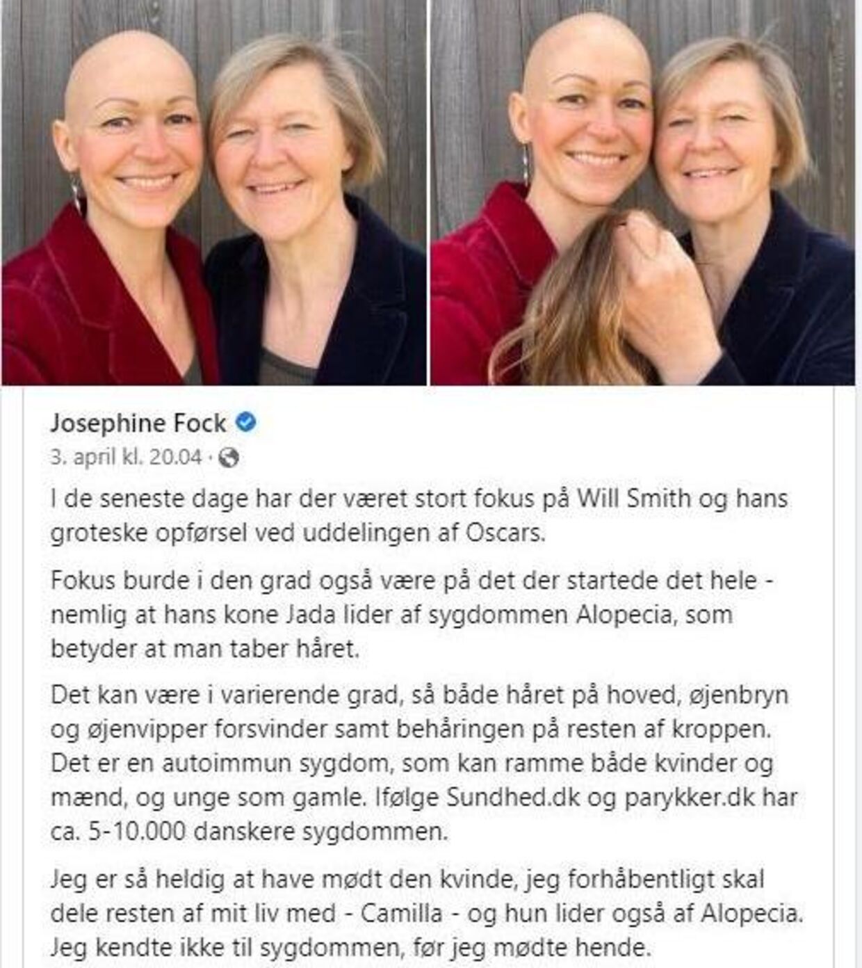 Parret offentliggjorde deres forhold på Josephine Focks Facebook og delte ud af deres erfaringer med Camillas sygdom.