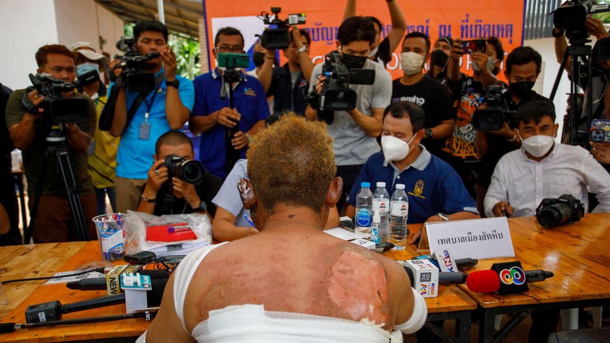 Chalit Chotisupakarn, a survivor of the Mountain B nightclub fire where at least 13 people were killed and 35 injured when a fire broke out early on Friday, speaks to authorities, in Chonburi province, Thailand, August 5, 2022. REUTERS/Tanat Chayaphattharitthee NO RESALES.NO ARCHIVES.
