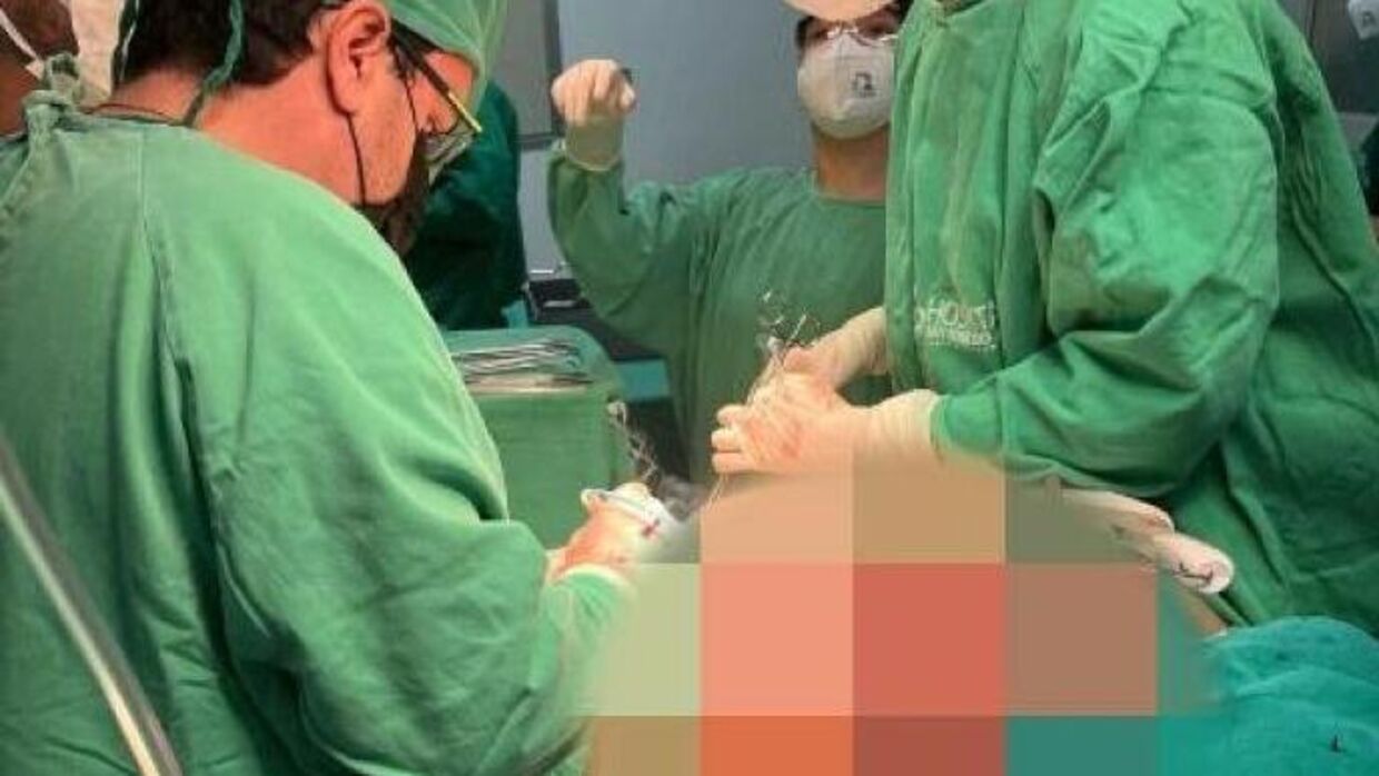 Lægerne brugte timer på at operere den store tumor væk.