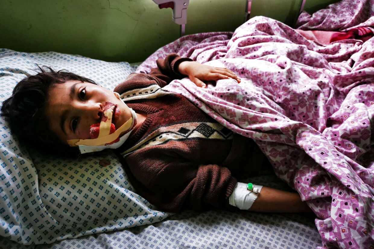 En såret afghansk dreng indlagt på et hospital efter et bombeanslag onsdag mod en koranskole i byen Aybak. Mindst 16 blev dræbt og 24 andre blev såret. -/Ritzau Scanpix