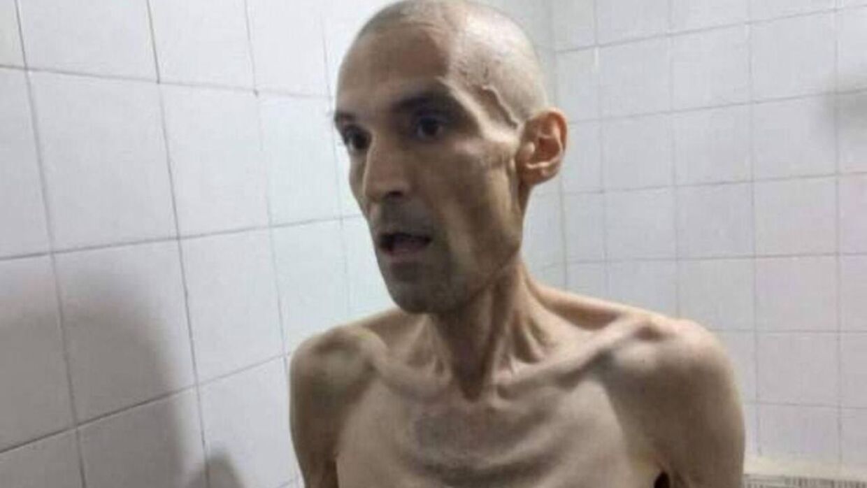 Menneskerettighedsforkæmperen Farhad Meysami har tabt 52 kilo under en sultestrejke i fængslet i Iran.