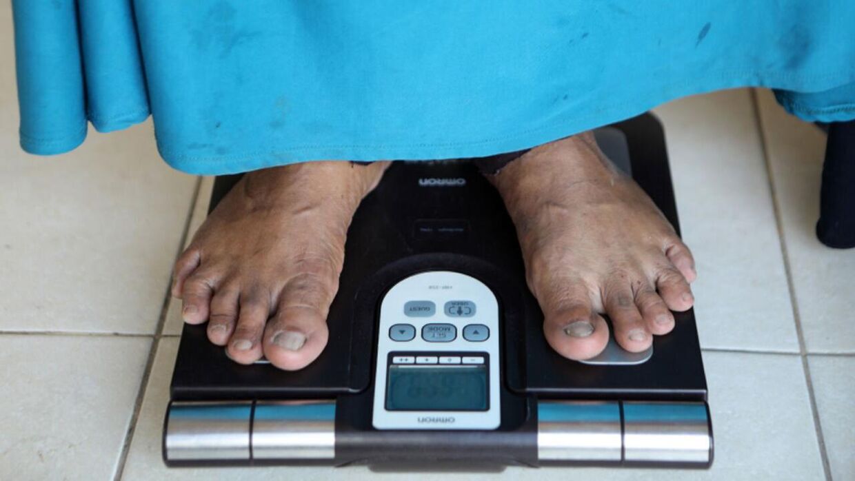(ARKIV) Vægttab hos ældre kan være et advarselstegn for tilstande som kræft og demens, viser ny undersøgelse.