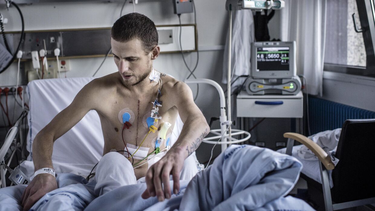 29-årige Michael Lunding har som den første dansker fået indopereret den nyeste version af et mekanisk hjerte, HeartMate III, som skal holde ham i live, indtil han kan få et donorhjerte. Foto: Thomas Lekfeldt