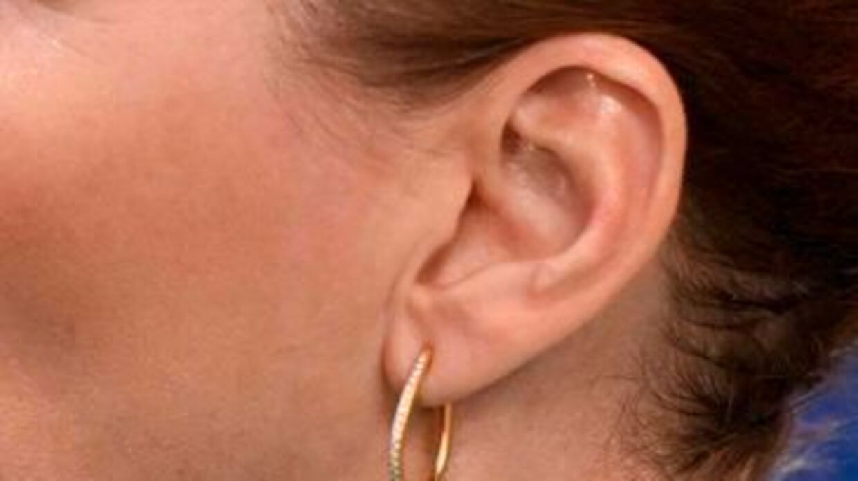 Unge får i stigende grad tinnitus og det vækker bekymring
