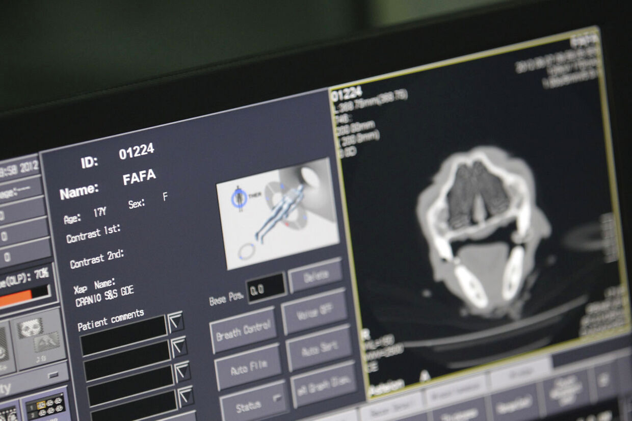 CT scanning af en hjerne