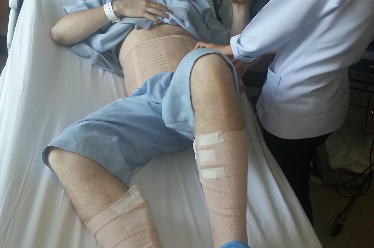 Et forretningsmøde i den thailandske by Pattaya endte galt for en yngre dansk forretningsmand, der endte med at blive overfaldt og frarøvet ca. 83.000 kr. Her ses han på hospitalet i Pattaya. 