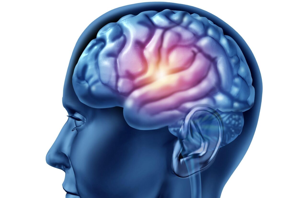 Мозг терапия купить. Послеоперационная киста в головном мозге. Киста головного мозга фото.