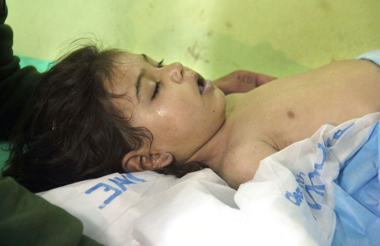 Et ungt barn modtager behandling efter gasangrebet på Khan Sheikhun. Mere end 80 personer menes at have mistet livet.
